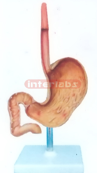 ULCERS STOMACH MODEL WITH DESCRIPTION PLATE